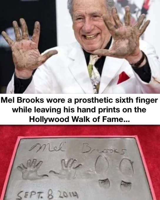 Mel Brooks wore a prosthetic sixth finger while leaving his hand prints on the Hollywood Walk of Fame...

Mel Brooks  
SEPT. 8 2014